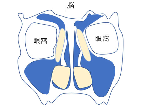 当院では日帰り副鼻腔炎 蓄膿症 の手術やっております そしがや駅前耳鼻咽喉科